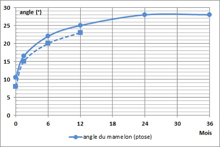 [ image: graphique angle du mamelon ]