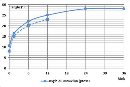 [ image: graphique angle du mamelon ]